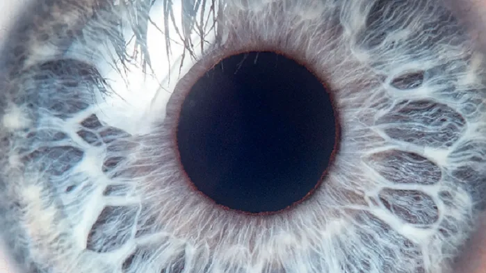 Brochure Gipp : La membrane épirétinienne