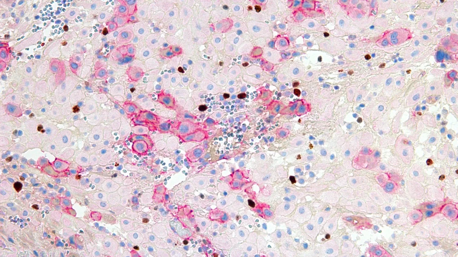 recherche - Centre des Maladies Trophoblastiques