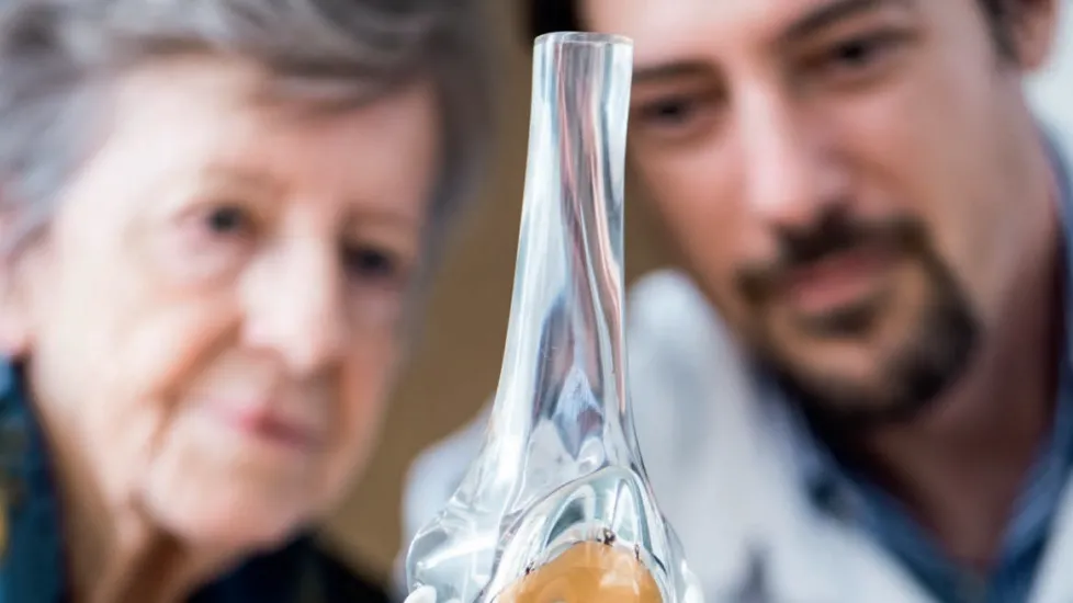 Prothèse totale de genou