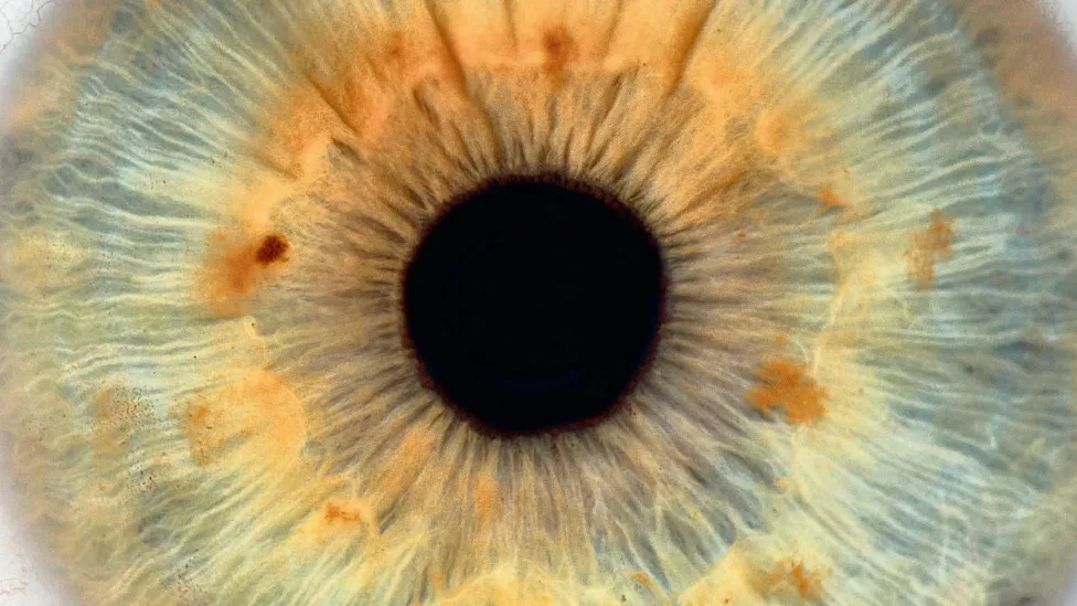 Brochure pour les patients : le glaucome