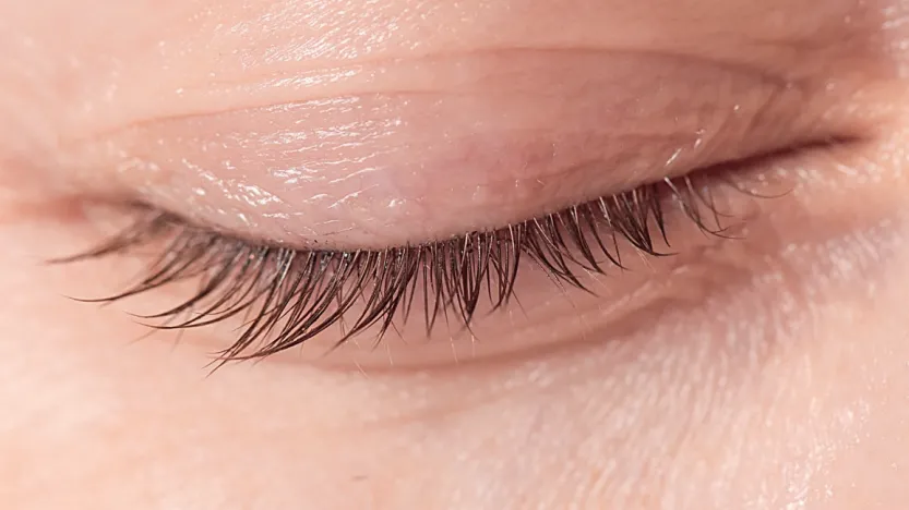 Brochure : Hygiène des paupières