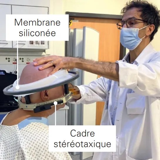 FUS : calibration de la machine