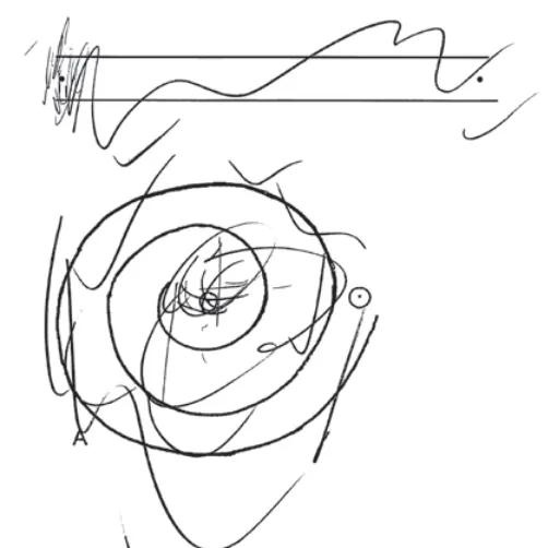 exemple amélioration : avant la FUS