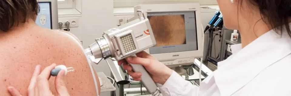 Oncologie - cancer de le peau