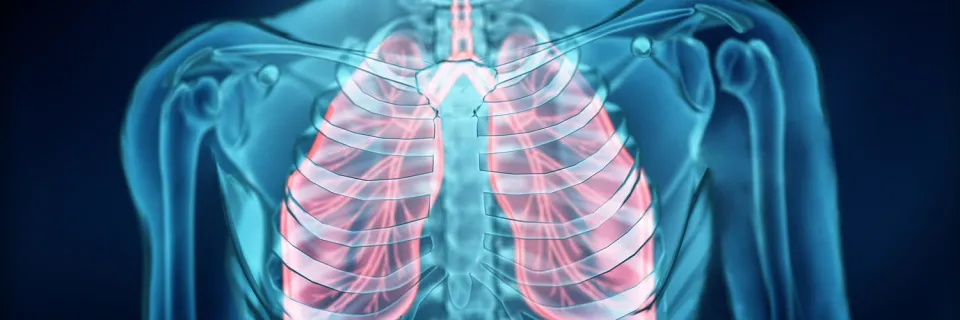 Poumons - Maladies vasculaires pulmonaires