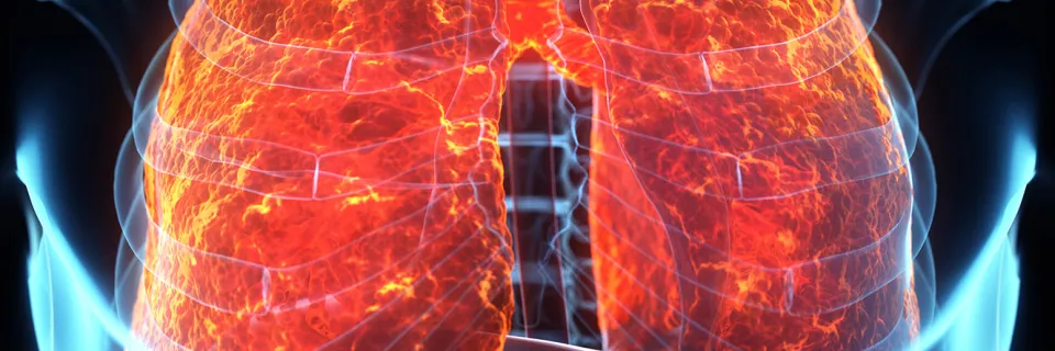 Mucoviscidose - Service de pneumologie aux HUG