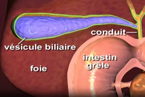 infographie : la vésicule biliaire