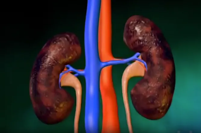 l'insuffisance rénale