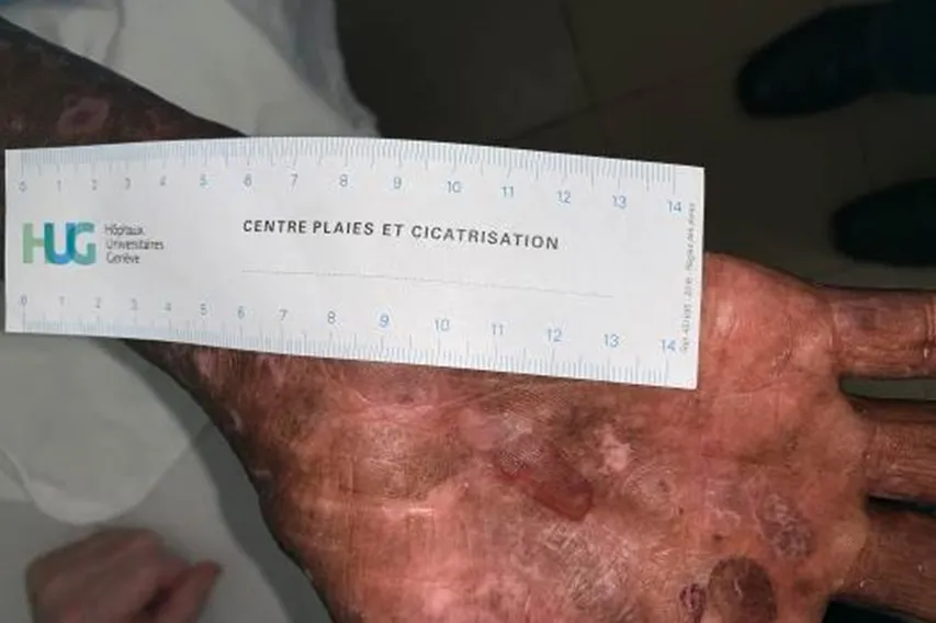 Projet Regional dermatology training center