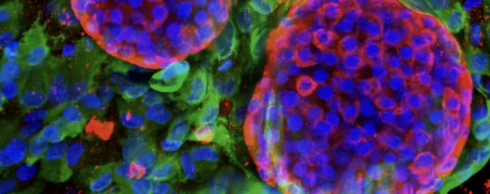 Pancréas bioartificiel vascularisé - © Berishvili Lab, University of Geneva