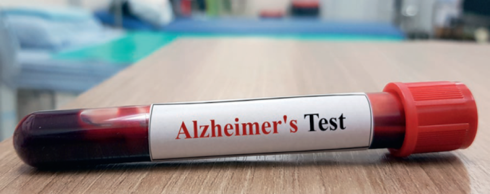 Les biomarqueurs sanguins d’alzheimer pourraient grandement simplifier le diagnostic et en réduire le coût - © joel bubble ben-Shutterstock.com