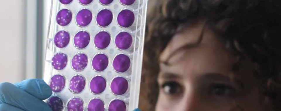 Test de neutralisation par réduction de plaque