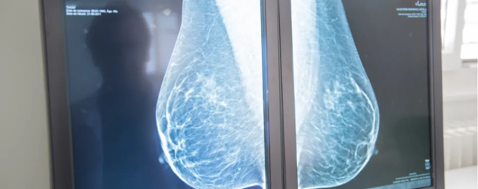 L’Hôpital de la Tour devient partenaire de réseau du Centre du sein des HUG