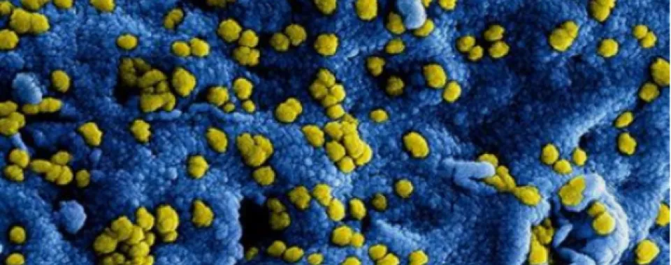 Les HUG déploient leur dispositif de gestion de crise