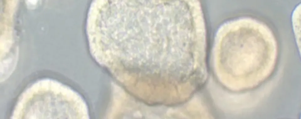 Image de cultures organoïdes 3D de cellules ovariennes cancéreuses - Université de Berne