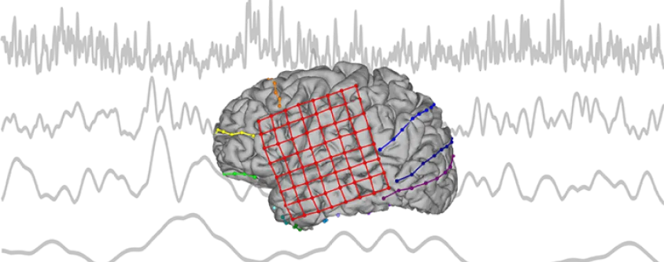 Décoder le langage intérieur pour soigner les troubles de la parole  - © UNIGE