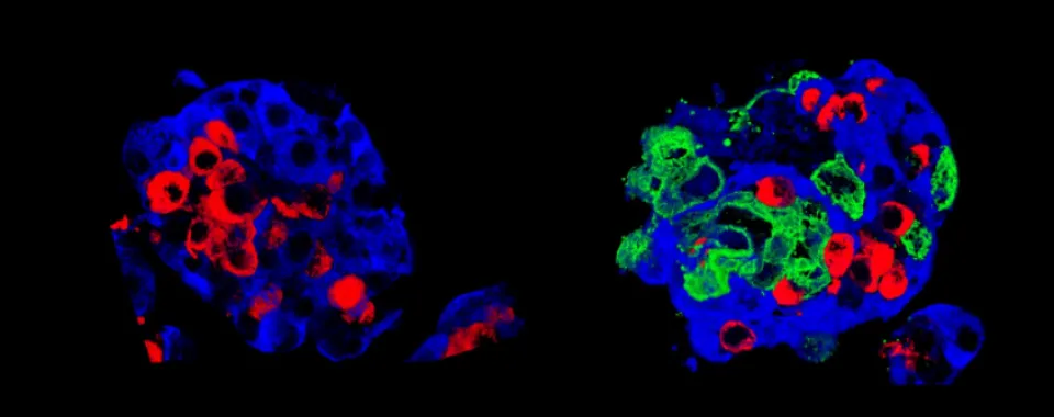 Îlots de Langerhans  - © UNIGE