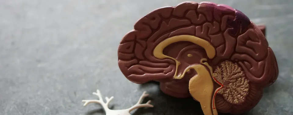 TDAH et démence - Image d'une coupe de cerveau