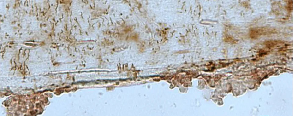 La periostine dans l’os - Copyright : HUG