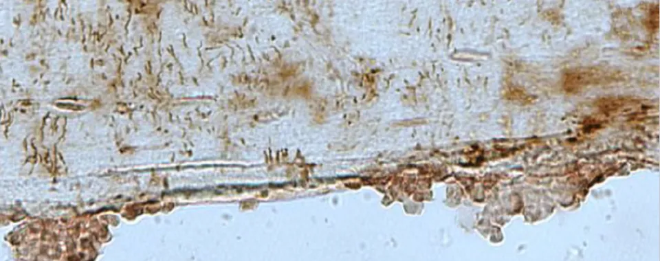 La periostine dans l’os - Copyright : HUG