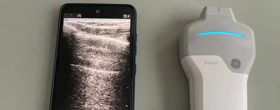 Appareil d'ultrasonographie portatif - HUG