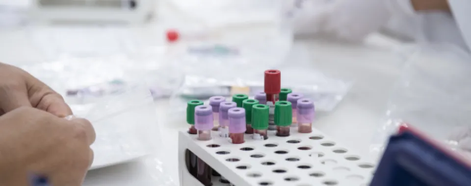 Dopage sanguin - © 2015 Julien Gregorio/phovea/HUG