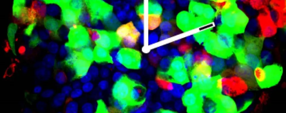 ©UNIGE, Dibner Lab. A Langerhans Islet with insulin-producing cells (in green), and glucagon-producing cells (in red). Cell nuclei in blue.