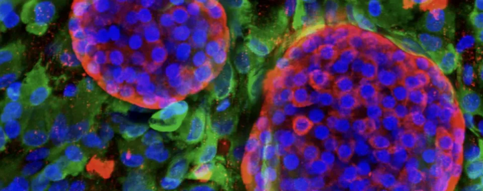 Pancréas bioartificiel vascularisé: des amas de cellules insulaires productrices d'insuline (en rouge) sont logés dans une structure souple en hydrogel peuplée de cellules endothéliales (en vert). © Berishvili Lab, University of Geneva