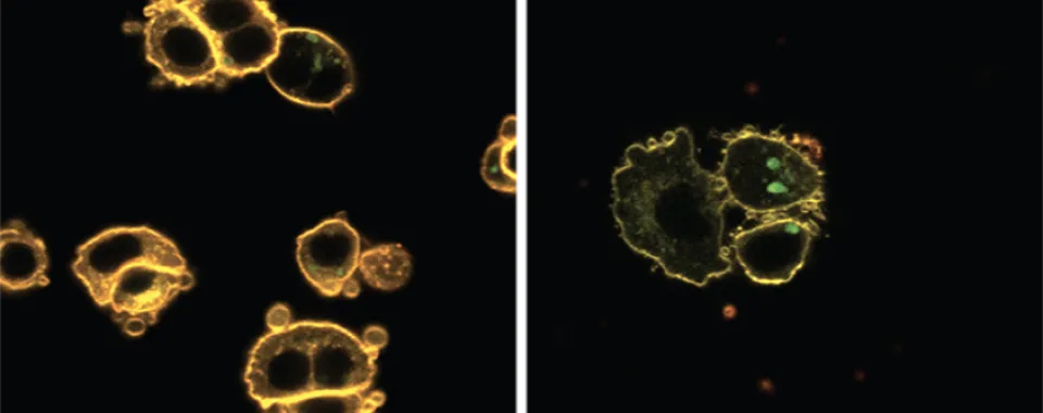 Les horloges cellulaires dans les îlots pancréatiques humaines contrôlent le fluidité membranaire © 2022 Petrenko et al. (2022) Type 2 diabetes disrupts circadian orchestration of lipid metabolism and membrane fluidity in human pancreatic islets. PLoS Biol 20(8): e3001725.