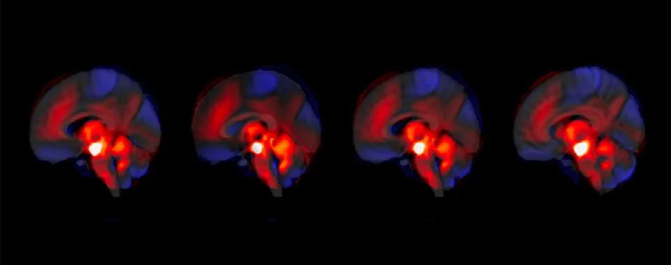 Image d’illustration de la connectivité entre le cervelet et l'ATV. (Indrit Bègue et al., 2025) © Thomas Bolton